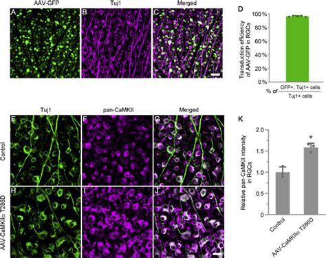 Preservation Of Vision After Camkii Mediated Protection Of Retinal