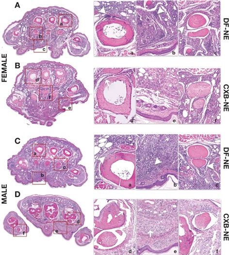 Sex Differences Revealed In A Mouse CFA Inflammation Model With Macrophage Targeted