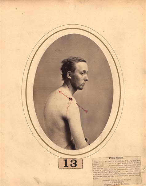 Eerie Vintage Portraits of Wounded Soldiers During the American Civil ...