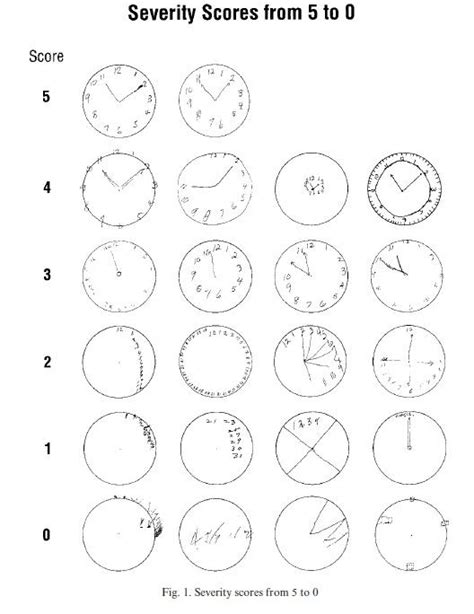 Alzheimer S Can Be Diagnosed By Drawing A Clock R Interestingasfuck