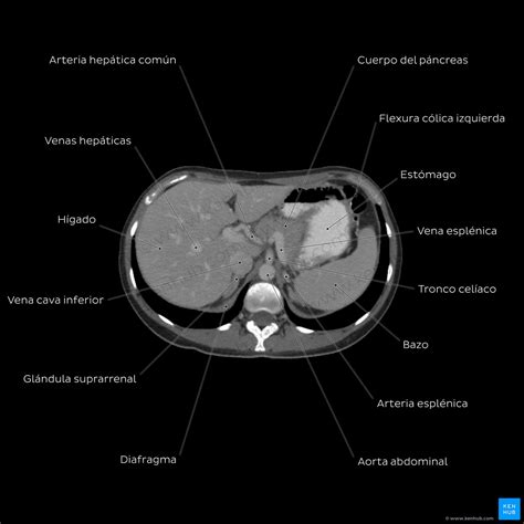 Anatomía radiológica Rayos X TAC RM Kenhub