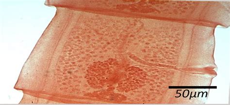 Taenia Saginata Mature Proglottides Parasitology