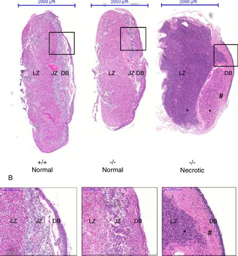 Placenta Histology Labelled