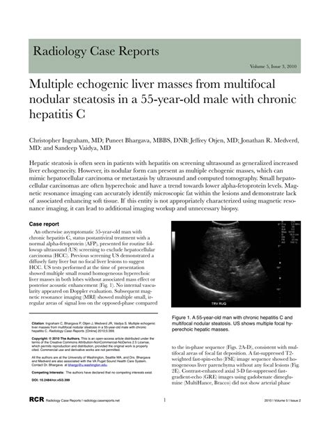 PDF Multiple Echogenic Liver Masses From Multifocal Nodular Steatosis