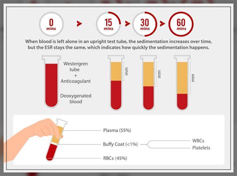 ESR Test: Testing, Levels, and More - Engiomed