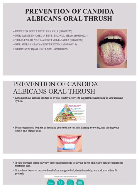 Prevention of Candida Albicans Oral Thrush | PDF | Candidiasis | Mouth