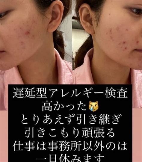 Hot girl phim để lộ nhan sắc thật chứng minh ảnh quảng cáo chỉ