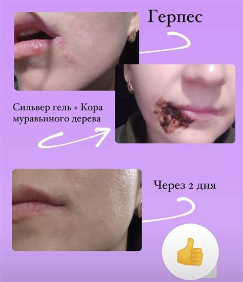 Сильвер гель Коралловый клуб