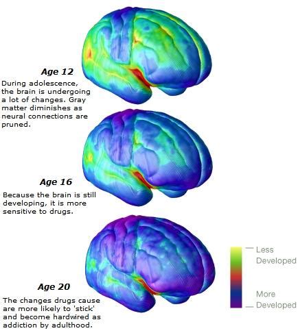 See What S Happening Inside Of The Teenage Brain Adolescent Brain