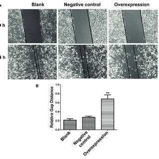 Migration Capacity Of Liver Cancer Cells Detected Via Wound Healing