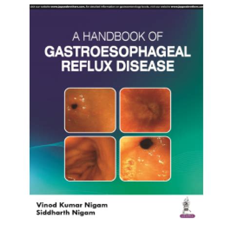 Handbook Of Gastroesophageal Reflux Disease 1st Edition 2024 By Vinod