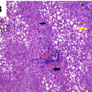 Photomicrograph Of Liver Sections H E A B Negative Control Rat