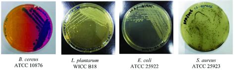 Bacteria cultured on selective agar plate after 24 hr incubation at 37 ...