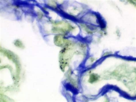 Pneumocystis Stain Kit