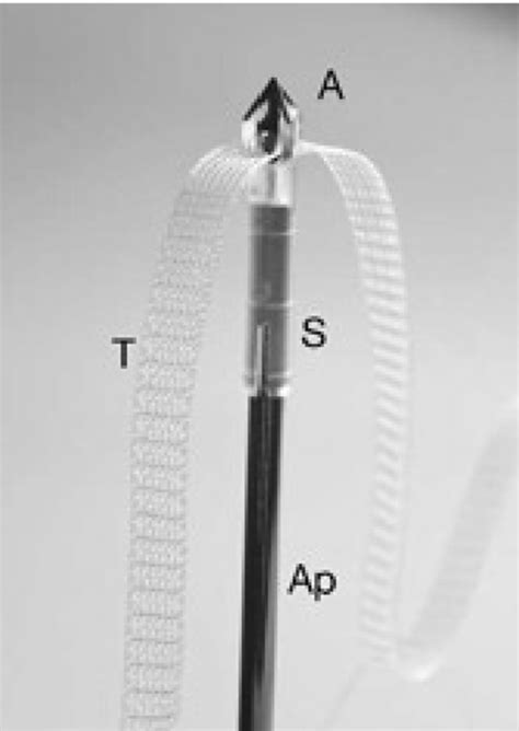 Posterior Tfs Sling Perspective View From Above The Tfs Anchors