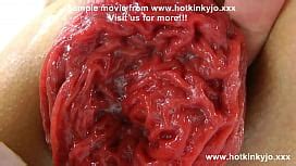 Dismoralica Extreme Deep Anal Insertions XNXX