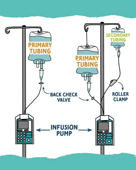 Iv Tubing Explained Nurseinthemaking Clinical Tips Medical School