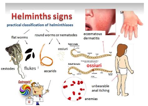 Roundworm In Humans Signs And Symptoms