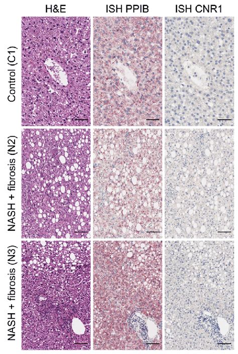 Cnr1 Mrna Expression In Control And Nash Human Livers Left Panel