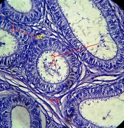 Cross Section Of Rabbits Testes Shows The Seminiferous Tubule Contain