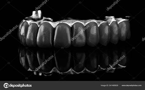 dental titanium beam blue teeth  wax  patients smile stock