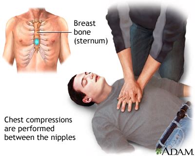 Hand Placement For Chest Compressions