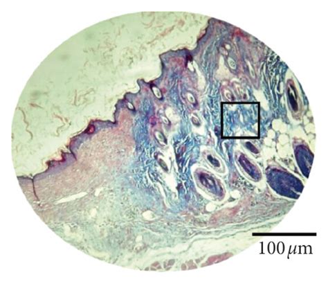 Inflammatory Infiltrate And Fibroblasts On The 9th Day After Lesion