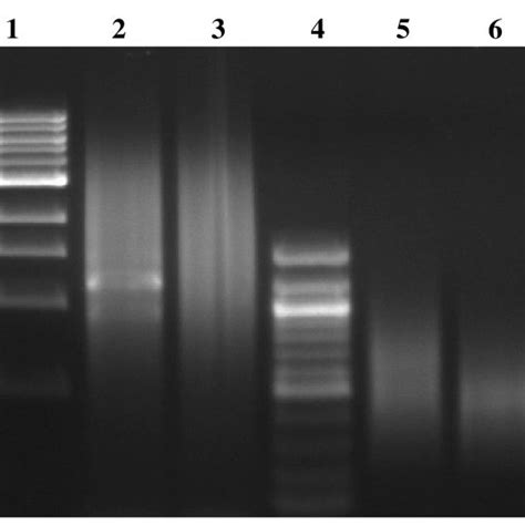 Agarose Gel Electrophoresis 1 Of Smart Cdna Normalized Cdna And