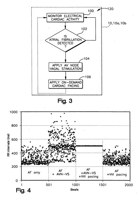 VENTRICULAR RHYTHMS patented technology retrieval search results