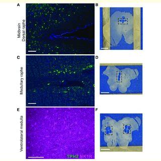 Brainstem nuclei identification for LCM. Immunohistological ...