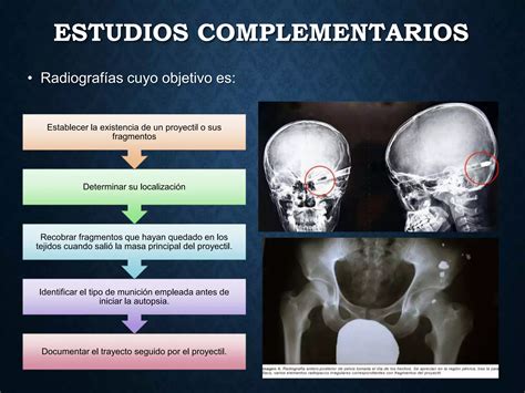 Heridas Por Arma De Fuego Ppt