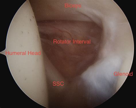 Arthroscopy The Bone School