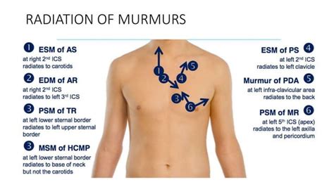 Cardiac Murmur & Dynamic Auscultation.pptx