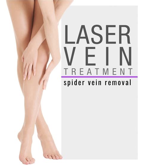 Laser Vein Treatment Spider Vein Removal Dallas Fort Worth Texas