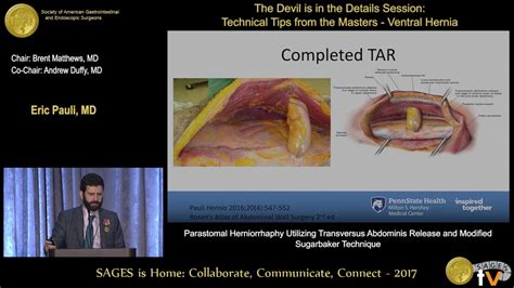 Parastomal Herniorrhaphy Utilizing Transversus Abdominis Release