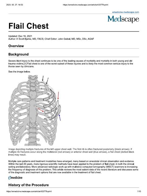 Flail Chest Pdf