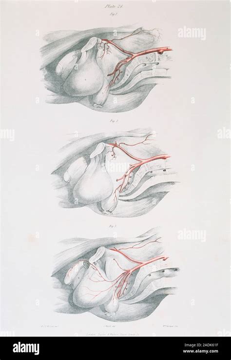 Pelvic Arteries Historical Illustration Of The Arteries And Organs Of