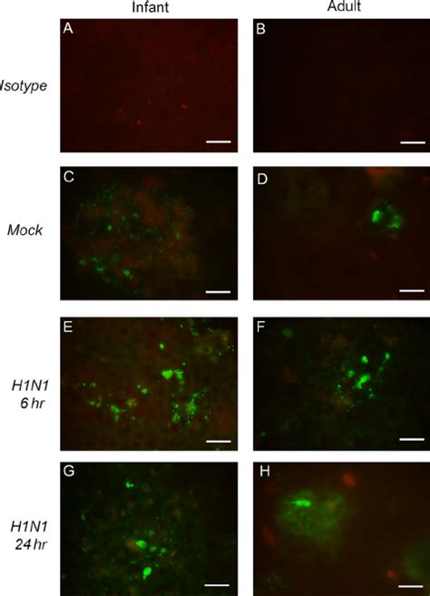 Cleaved Caspase 3 Immunofluorescent Staining In Infant And Adult