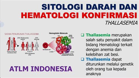 Thallasemia Hematologi Patofisiologi Diagnosis Laboratorium Mayor