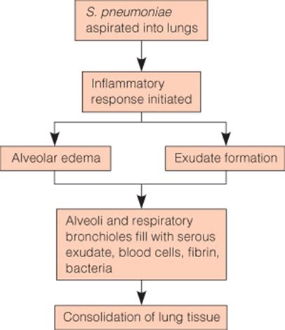 Pneumonia Test2 Flashcards Quizlet