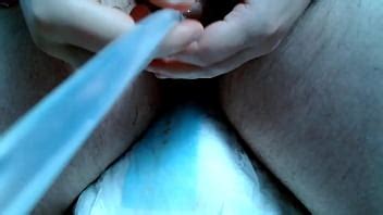 Cambio de catéter de fr a fr XVIDEOS