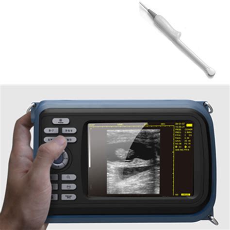 Digital Portable Handheld Ultrasound Scanner Machinetransvaginal Prob Diagnostic Ultrasound