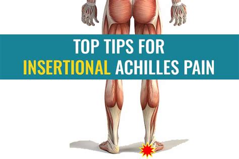 Top Tips For Insertional Achilles Tendinopathy Treat My Achilles