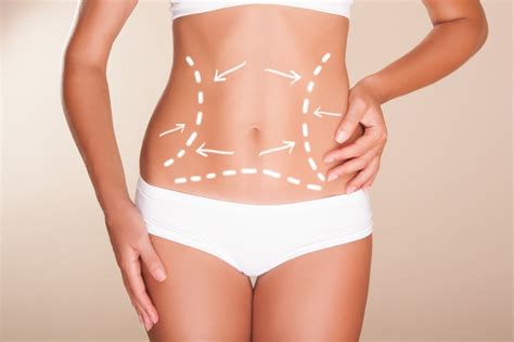 What You Need To Know About Liposuction Health Sone