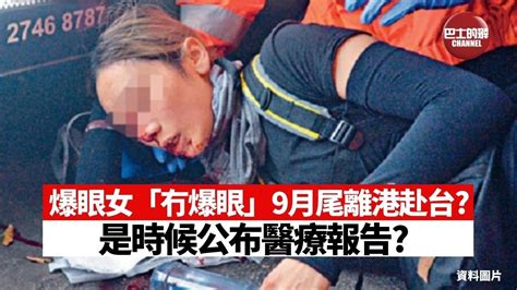 爆眼 國安法 台灣【晨早直播】 爆眼女被指去年9月尾已離港赴台 是時候公布醫療報告 Youtube