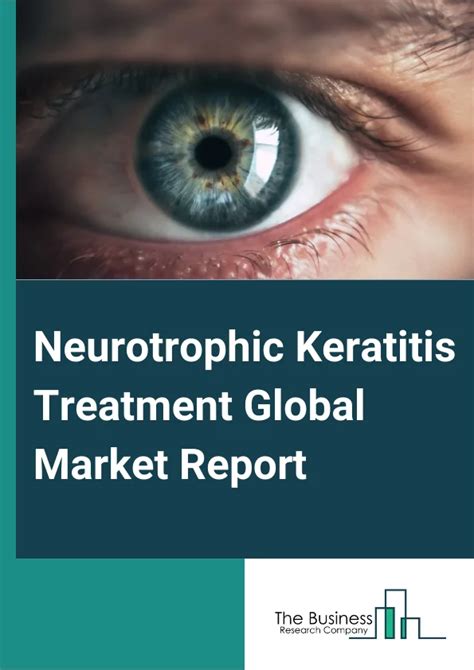 Neurotrophic Keratitis Treatment Market Size Analysis And Forecast 2024 2033