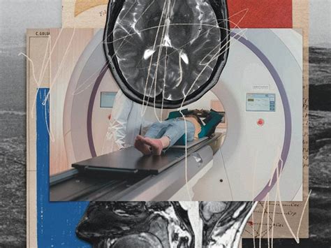 Are Whole-Body MRI Scans Too Good to Be True? | Best Health