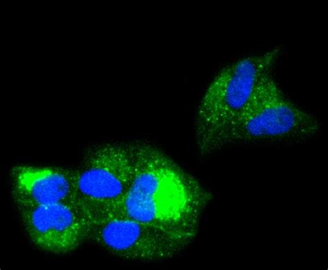 Beta 2 Microglobulin B2m Antibody A00456 5