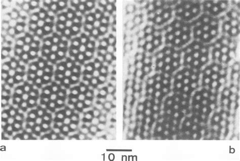 Processed Electron Micrographs Of Negatively Stained Uranyl Acetate