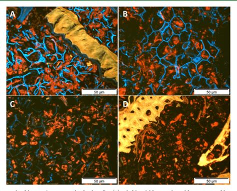 Pdf Enzyme Aided Recovery Of Protein And Protein Hydrolyzates From